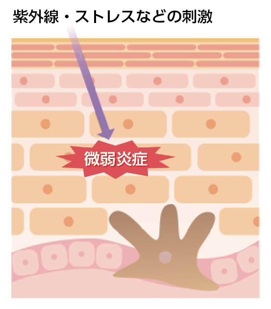 紫外線やストレスによる刺激が原因で肌に微弱炎症が発生する仕組みを示したイラスト