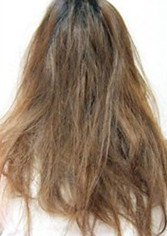 乾燥とダメージで傷んだ髪の状態を示す写真。パサつきや広がりが目立つ女性の髪の毛