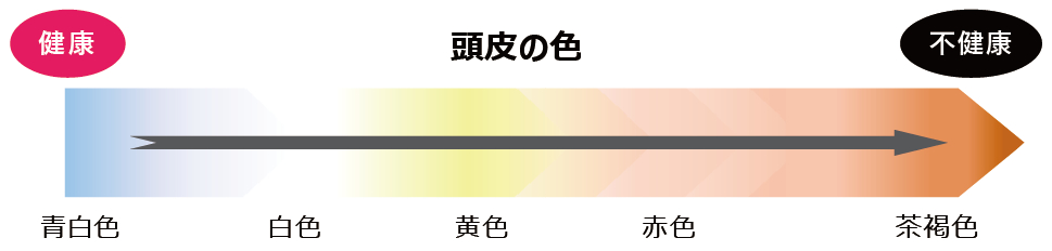 頭皮の健康状態を示す図。青白色が健康、茶褐色が不健康を表す