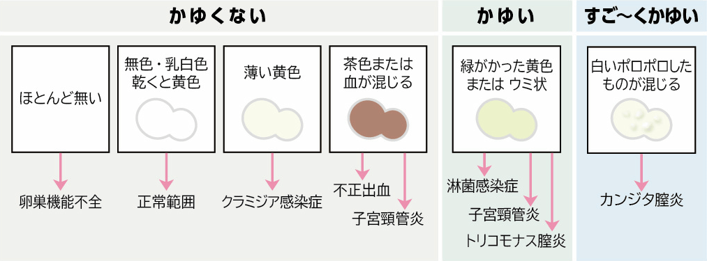 オリモノの状態別特徴と考えられる原因（正常範囲、クラミジア感染症、カンジダ膣炎など）