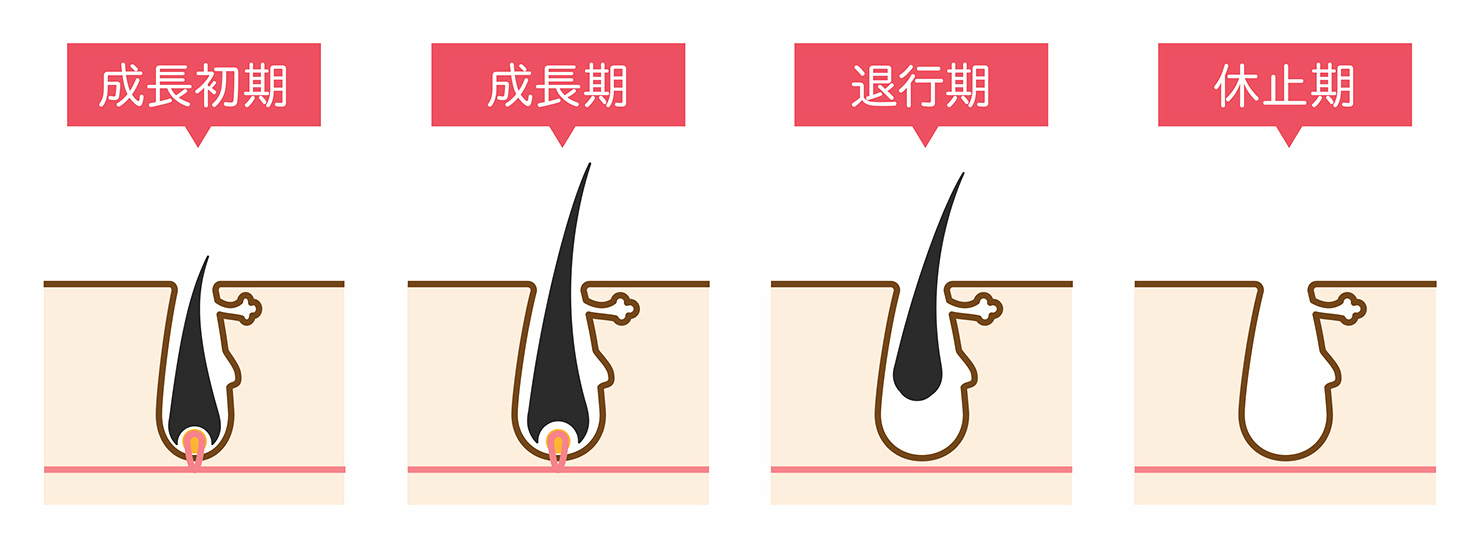 髪のヘアサイクル（毛周期）を示すイラスト。成長初期、成長期、退行期、休止期の各段階を図解で表現